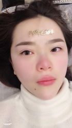 -郡艺医疗美容·微整·眼鼻吸脂