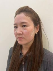 -海涛医疗美容·面部抗衰·注射美鼻