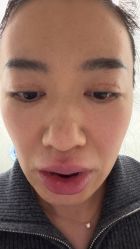 点击看大图 -欧扬医疗美容