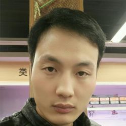 -碧莲盛·不剃发植发