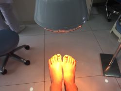 -派恩宜灰指甲·甲沟炎·鸡眼康护