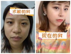 -素美医疗美容·西南眼鼻整形·修复基地