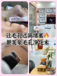 -靓芙泉祛痘.科技美肤连锁