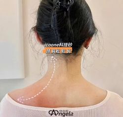 -安吉拉青春化管理中心