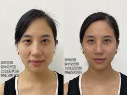 点击看大图 -Yestar重庆艺星医疗美容医院