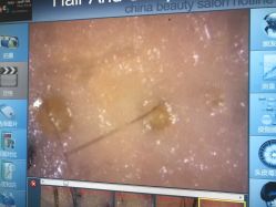 -雍禾植发全国连锁