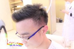 -大麦微针植发全国连锁