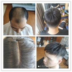 -发饰美男士增发补发假发定制店
