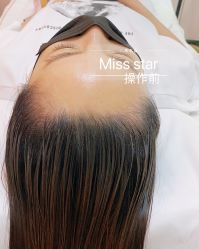 -MISS STAR·半永久纹眉·发际线·美瞳线