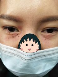 -北京美痣堂古方祛痣斑疣瘊