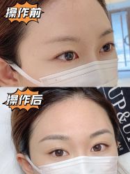 -UP&UP·半永久眉毛眼线机器野生眉