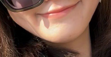 体验后-杭州美莱医疗美容医院