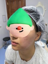 体验后-长沙雅美医疗美容医院