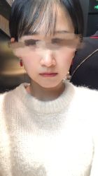 体验后-深圳美莱医疗美容医院