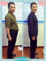 -维纳斯专业减肥