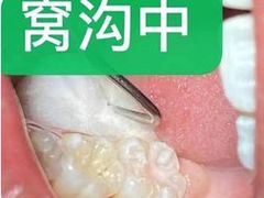 -团圆口腔·种植中心(锦江院区)