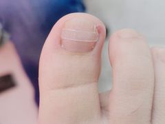 -新甲连锁灰指甲·甲沟炎·鸡眼(黑龙江路店)