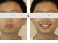 -齐玉齿科JADENTAL