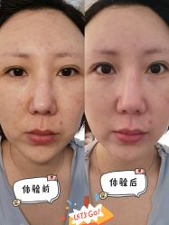 -广东韩妃整形外科医院