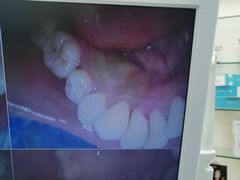 -牙博士口腔品牌连锁(杨浦店)