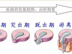 -香薇妮丝女子减肥院