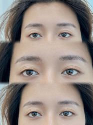 点击看大图 -张小野·专业半永久纹眉