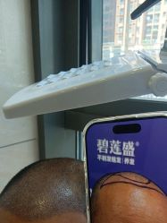 点击看大图 -碧莲盛·不剃发植发