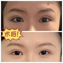 -素美医疗美容·西南眼鼻整形·修复基地