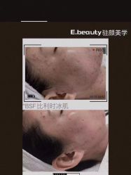 -E.beauty驻颜·痘敏肌调理中心