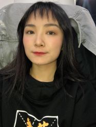 体验前-八大处整形