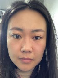 体验后-天河爱来医疗美容门诊部