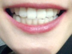 -上海康怡口腔门诊部Alpha Dental