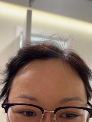 -海涛医疗美容·面部抗衰·注射美鼻