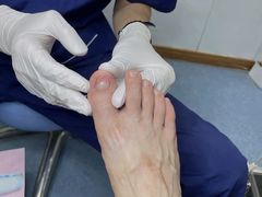 -Andrew指甲专科灰指甲·甲沟炎矫正·3D步态矫形鞋垫定制(上海法华镇路旗舰店)