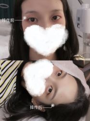 -YIMEI ART半永久纹眉·野生眉