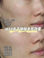 点击看大图 -南京康美美容医院·旗舰店