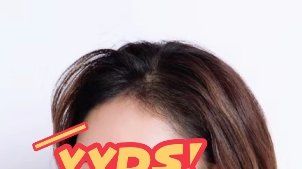 -大麦微针植发丨全国连锁