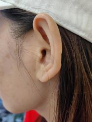 -美瑞莎创美医疗美容