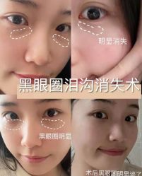 -上海漾颜医疗美容