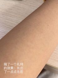 体验后-上海漾颜医疗美容