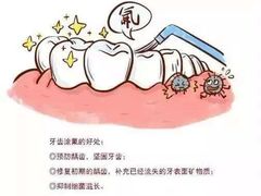 -团圆口腔·种植中心(锦江院区)