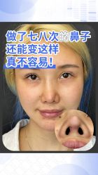 -北京米扬丽格医疗美容·联合丽格鼻整形中心