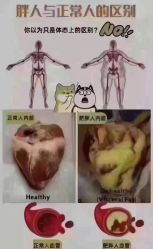 -香薇妮丝女子减肥院