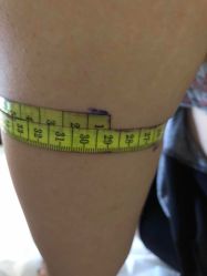 -肥三针腧穴瘦身馆