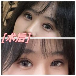 -素美医疗美容·西南眼鼻整形·修复基地