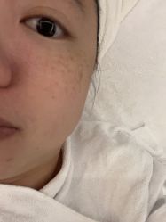 -AiCure 埃可儿·韩国医学皮肤管理