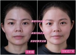 -美莱医学美容医院