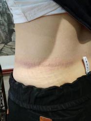 -秦好山专业洗纹身