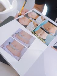 -Lily纤美·科技减脂中心