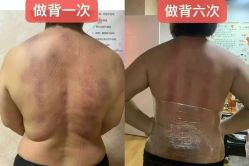 -丽减美瘦吧·减肥瘦身